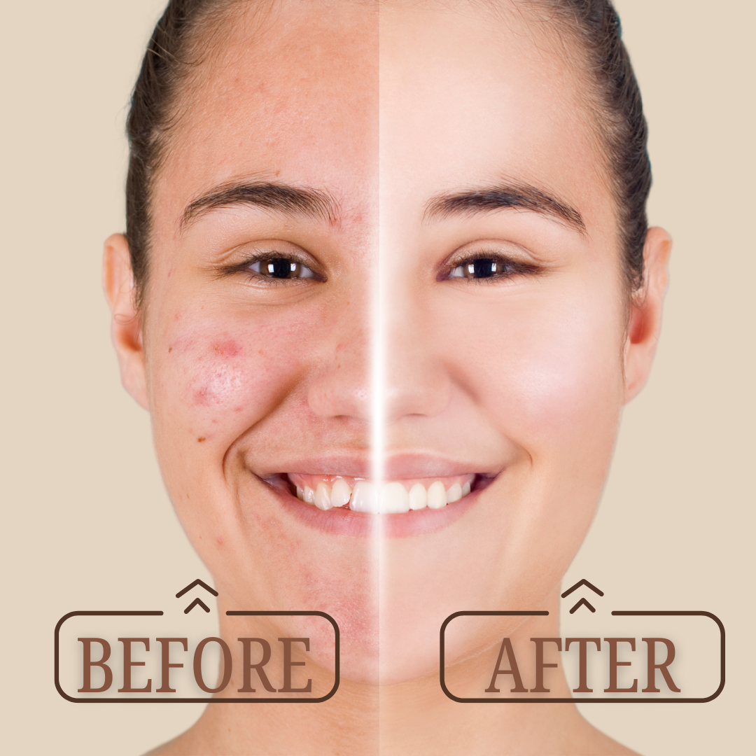 Face Serum with Vitamin C & Kumkumadi Oil Combo