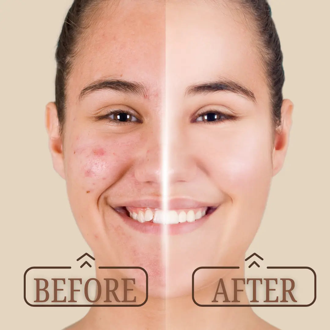 Mixxage Vitamin C Face Serum 