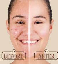 Mixxage Vitamin C Face Serum 